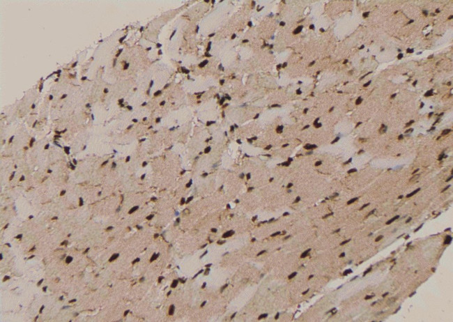 Phospho-ACK1 (Tyr284) Antibody in Immunohistochemistry (Paraffin) (IHC (P))