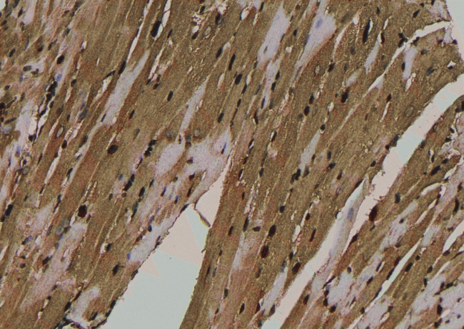 Phospho-NMDAR2A (Tyr943) Antibody in Immunohistochemistry (Paraffin) (IHC (P))