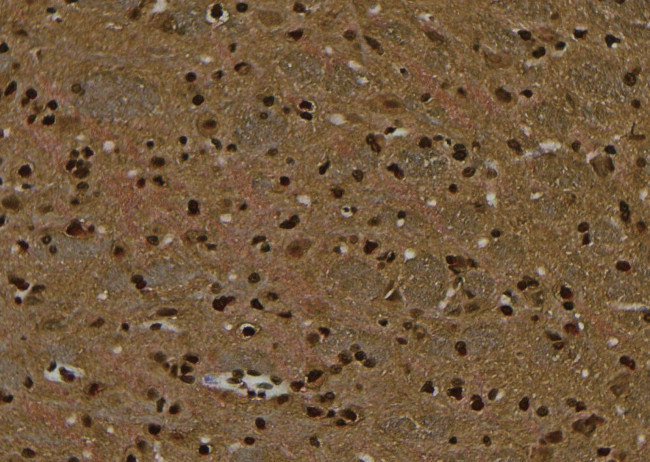 Phospho-NMDAR2A (Tyr943) Antibody in Immunohistochemistry (Paraffin) (IHC (P))