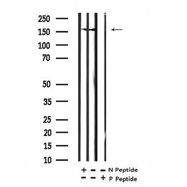 Phospho-NMDAR2A (Tyr943) Antibody in Western Blot (WB)