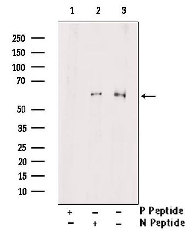 Phospho-TRAF2 (Thr22) Antibody in Western Blot (WB)