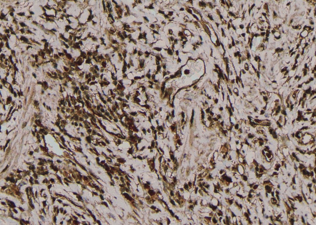 Phospho-Acetyl-CoA Carboxylase (Thr1196) Antibody in Immunohistochemistry (Paraffin) (IHC (P))