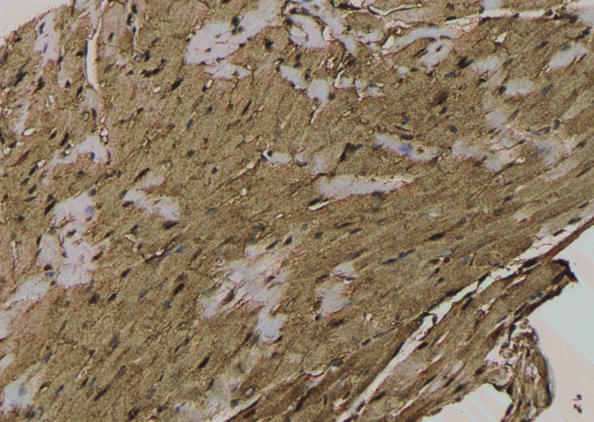 Phospho-Acetyl-CoA Carboxylase (Thr1196) Antibody in Immunohistochemistry (Paraffin) (IHC (P))