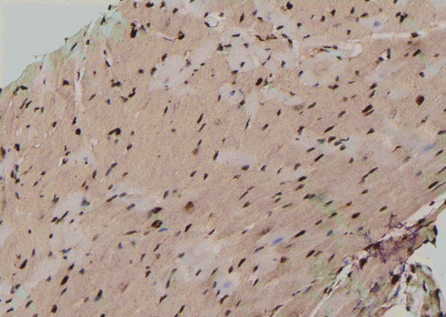 Phospho-TDP-43 (Ser409) Antibody in Immunohistochemistry (Paraffin) (IHC (P))