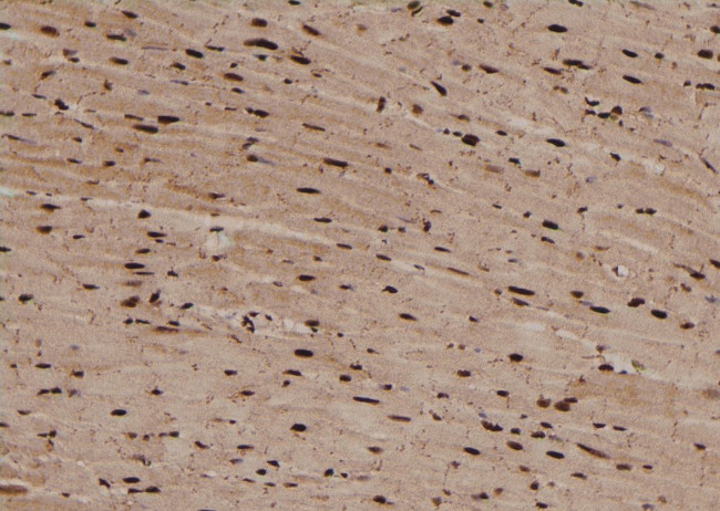 Phospho-TDP-43 (Ser409) Antibody in Immunohistochemistry (Paraffin) (IHC (P))