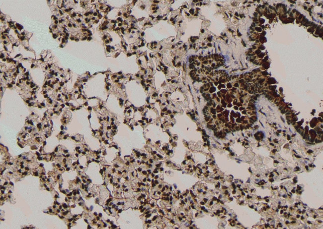 Phospho-TDP-43 (Ser409) Antibody in Immunohistochemistry (Paraffin) (IHC (P))