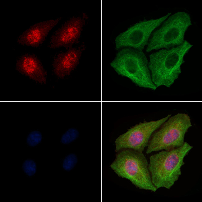 Phospho-TDP-43 (Ser409) Antibody in Immunocytochemistry (ICC/IF)