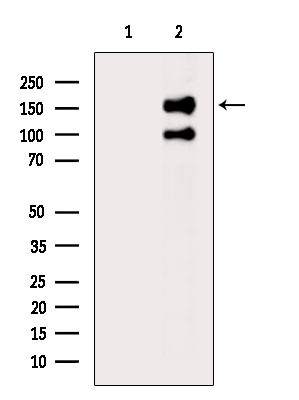 Phospho-NMDAR2B (Ser1303) Antibody in Western Blot (WB)