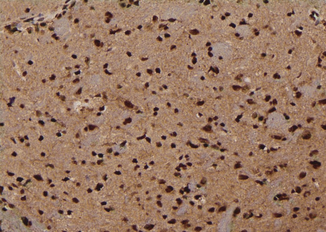 Phospho-NMDAR2B (Ser1303) Antibody in Immunohistochemistry (Paraffin) (IHC (P))