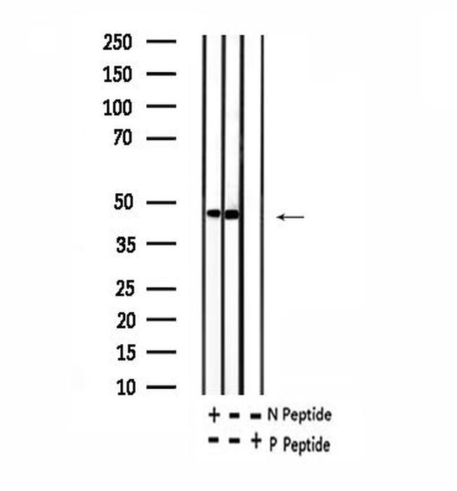 Phospho-SKP2 (Thr417) Antibody in Western Blot (WB)