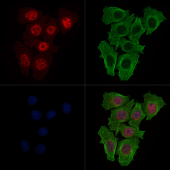 Phospho-SKP2 (Thr417) Antibody in Immunocytochemistry (ICC/IF)