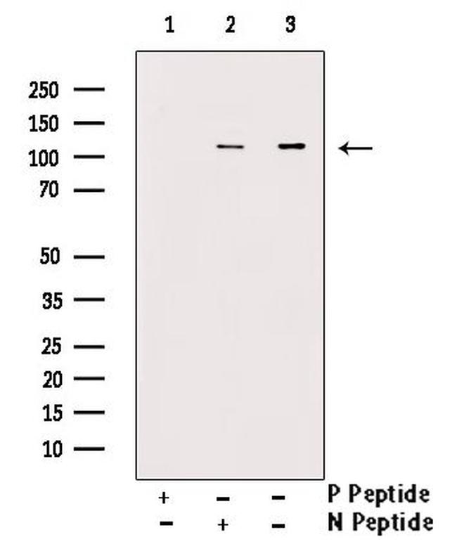 Phospho-PLD1 (Ser561) Antibody in Western Blot (WB)