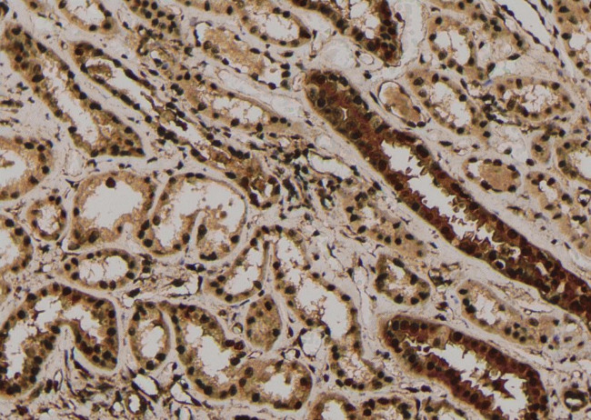 Phospho-4EBP1 (Thr45) Antibody in Immunohistochemistry (Paraffin) (IHC (P))