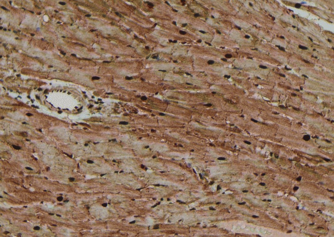 Phospho-4EBP1 (Thr45) Antibody in Immunohistochemistry (Paraffin) (IHC (P))