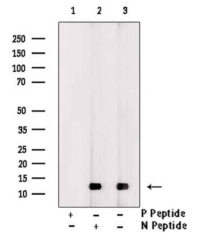 Phospho-4EBP1 (Thr45) Antibody in Western Blot (WB)