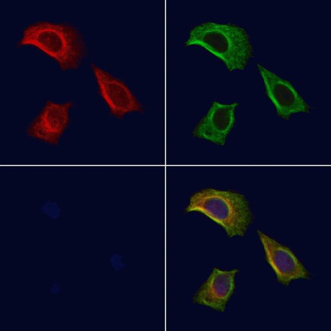 Phospho-RIP1 (Ser161) Antibody in Immunocytochemistry (ICC/IF)