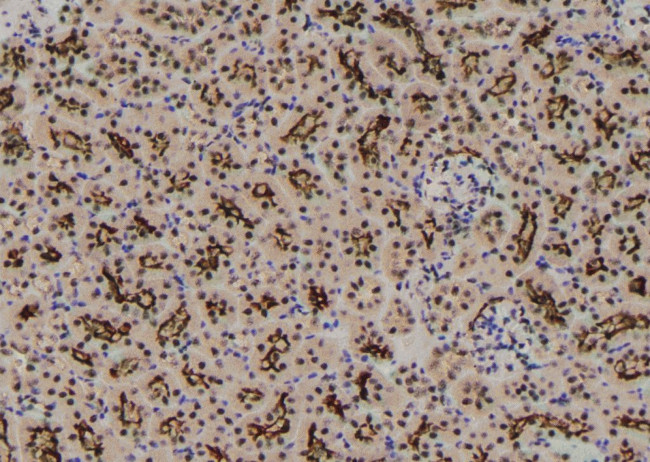 Phospho-RIP1 (Ser161) Antibody in Immunohistochemistry (Paraffin) (IHC (P))