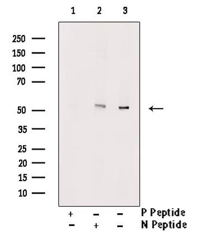 Phospho-RUNX2 (Ser275) Antibody in Western Blot (WB)