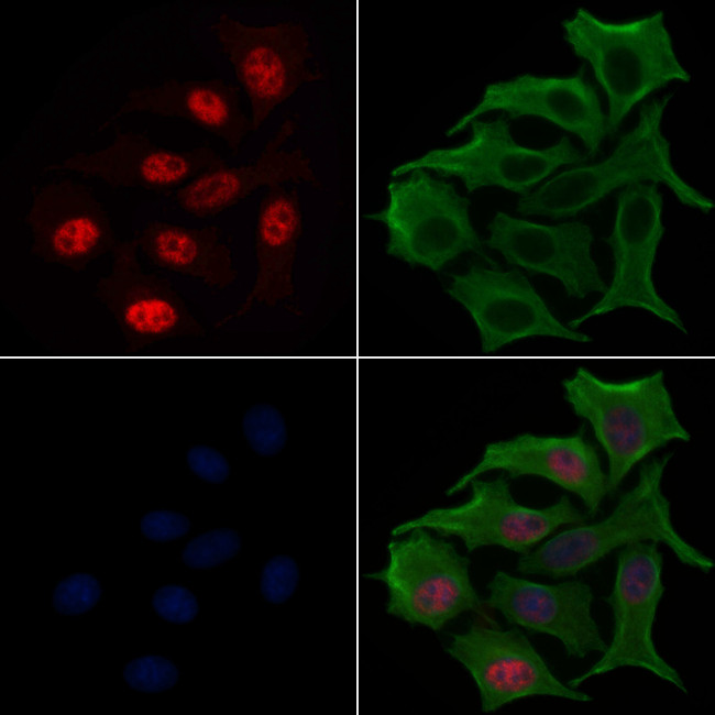 Phospho-RUNX2 (Ser275) Antibody in Immunocytochemistry (ICC/IF)