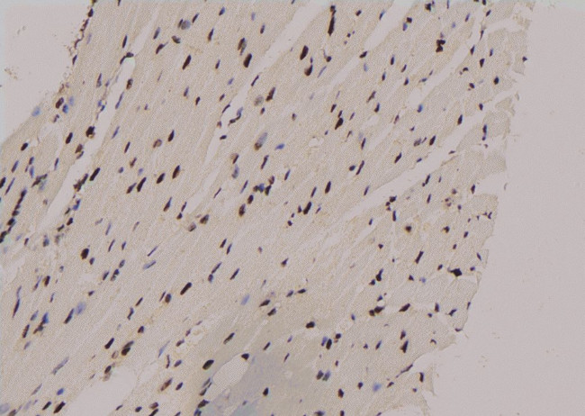 Phospho-RUNX2 (Ser28) Antibody in Immunohistochemistry (Paraffin) (IHC (P))