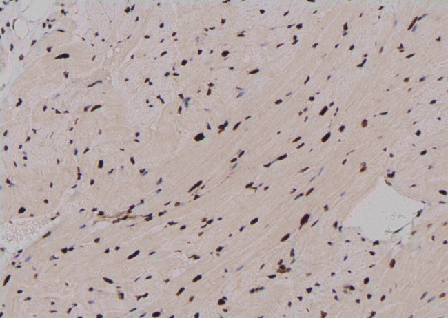 Phospho-RUNX2 (Ser28) Antibody in Immunohistochemistry (Paraffin) (IHC (P))