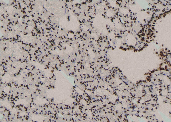 Phospho-RUNX2 (Ser28) Antibody in Immunohistochemistry (Paraffin) (IHC (P))