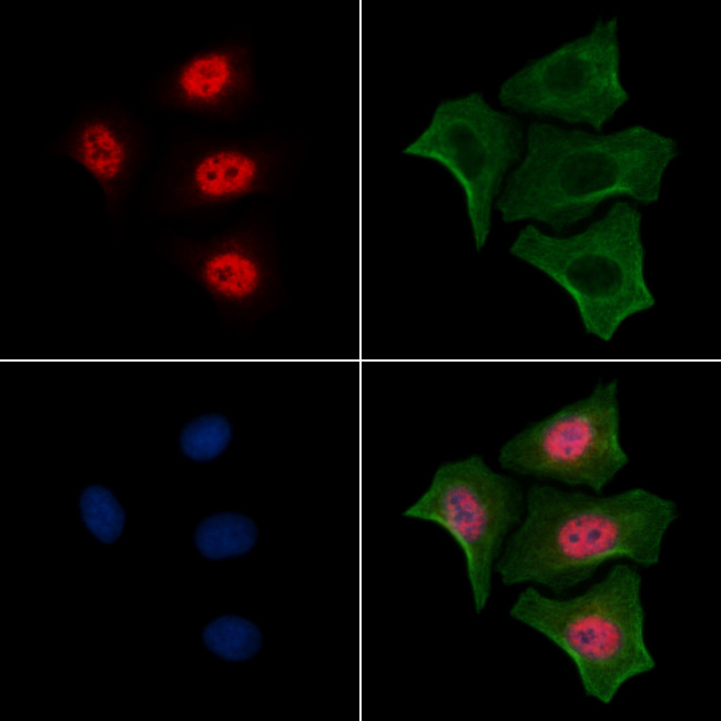 Phospho-RUNX2 (Ser28) Antibody in Immunocytochemistry (ICC/IF)