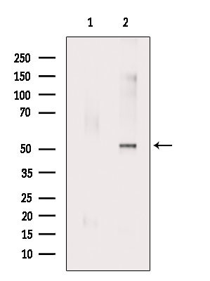 Phospho-RUNX2 (Ser28) Antibody in Western Blot (WB)