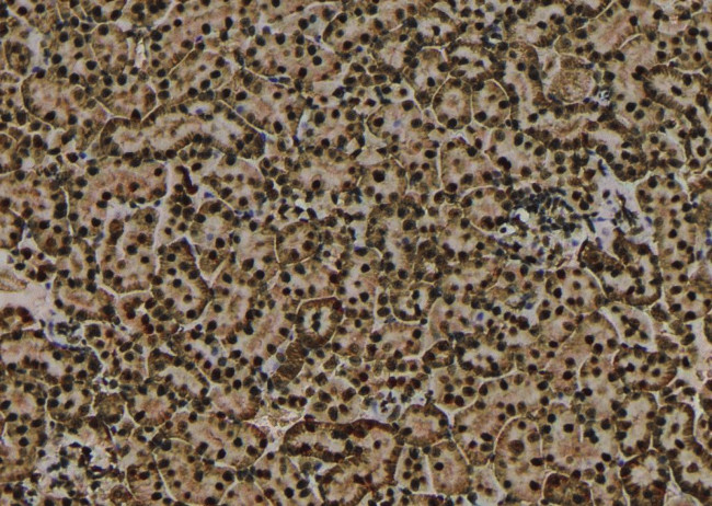 Phospho-CaMKI (Thr177) Antibody in Immunohistochemistry (Paraffin) (IHC (P))