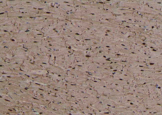 Phospho-Beclin 1 (Ser90, Ser93, Ser96) Antibody in Immunohistochemistry (Paraffin) (IHC (P))