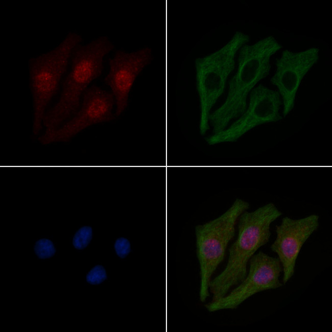 Phospho-IRF3 (Ser14) Antibody in Immunocytochemistry (ICC/IF)