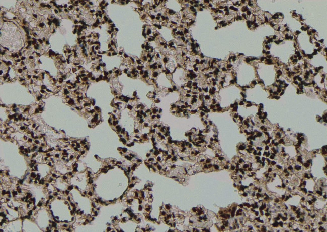 Phospho-IRF3 (Ser14) Antibody in Immunohistochemistry (Paraffin) (IHC (P))