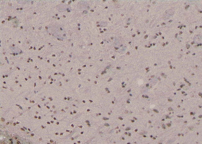 Phospho-NFATC4 (Ser289) Antibody in Immunohistochemistry (Paraffin) (IHC (P))