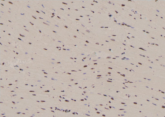 Phospho-NFATC4 (Ser289) Antibody in Immunohistochemistry (Paraffin) (IHC (P))