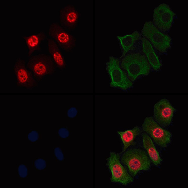 Phospho-NCOA2 (Ser698, Ser699) Antibody in Immunocytochemistry (ICC/IF)