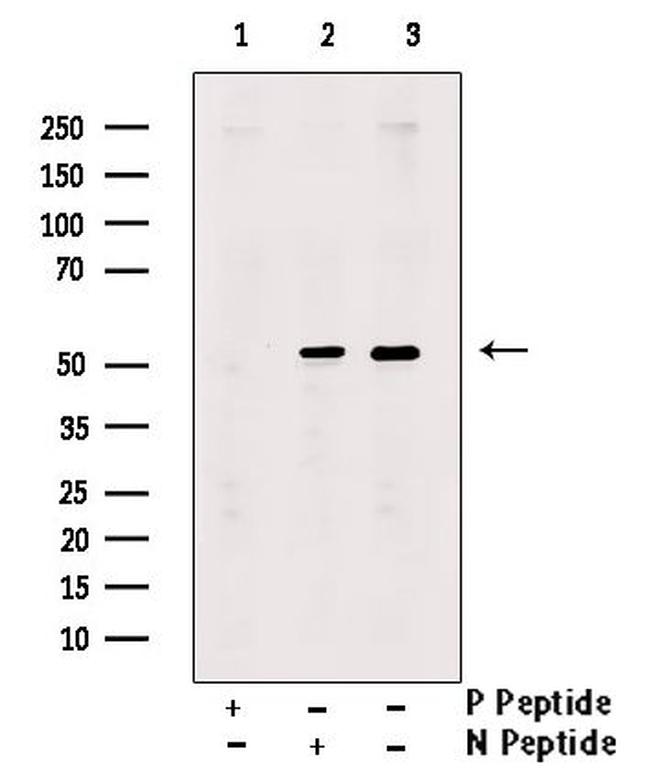 Phospho-LKB1 (Ser31) Antibody in Western Blot (WB)