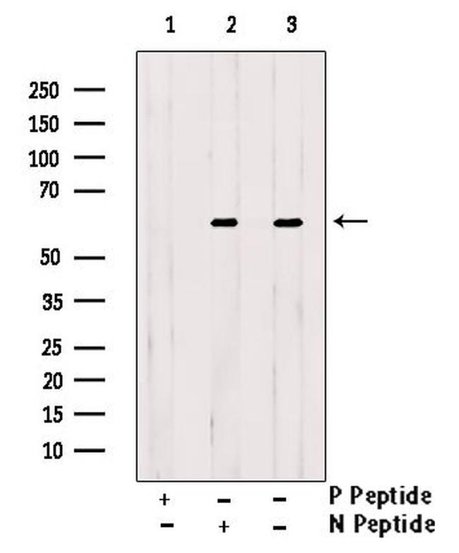 Phospho-GRK1 (Ser21) Antibody in Western Blot (WB)