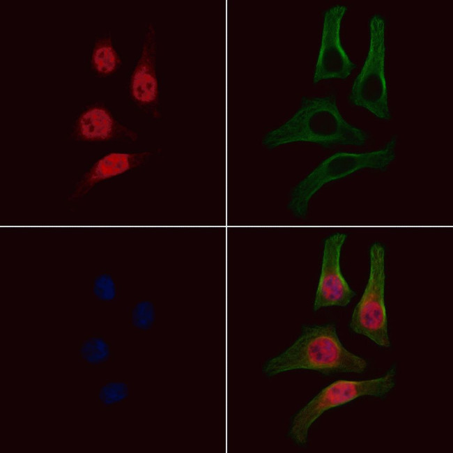 Phospho-EZH2 (Thr487) Antibody in Immunocytochemistry (ICC/IF)