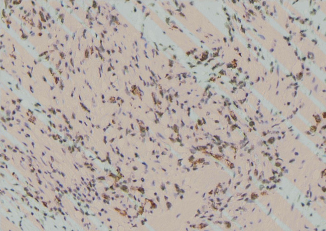 Phospho-Zyxin (Tyr316) Antibody in Immunohistochemistry (Paraffin) (IHC (P))