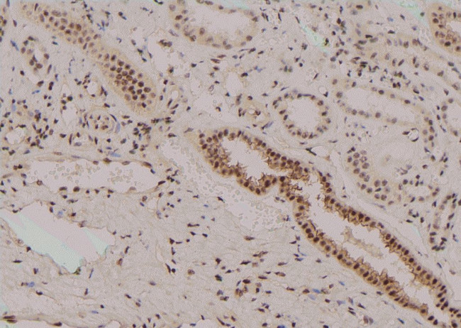 Phospho-Zyxin (Tyr316) Antibody in Immunohistochemistry (Paraffin) (IHC (P))