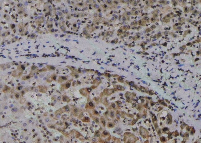 Phospho-Zyxin (Tyr316) Antibody in Immunohistochemistry (Paraffin) (IHC (P))