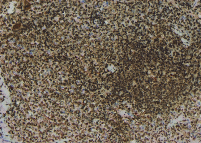 Phospho-Zyxin (Tyr316) Antibody in Immunohistochemistry (Paraffin) (IHC (P))