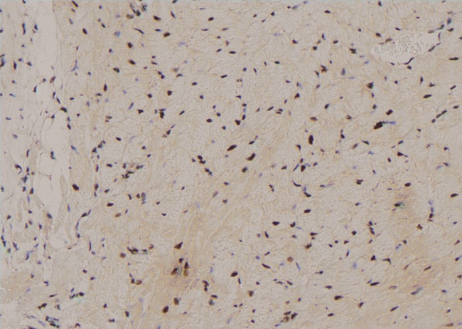 Phospho-Zyxin (Tyr316) Antibody in Immunohistochemistry (Paraffin) (IHC (P))