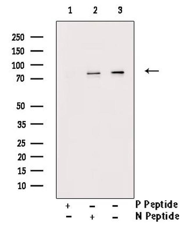 Phospho-Zyxin (Tyr316) Antibody in Western Blot (WB)