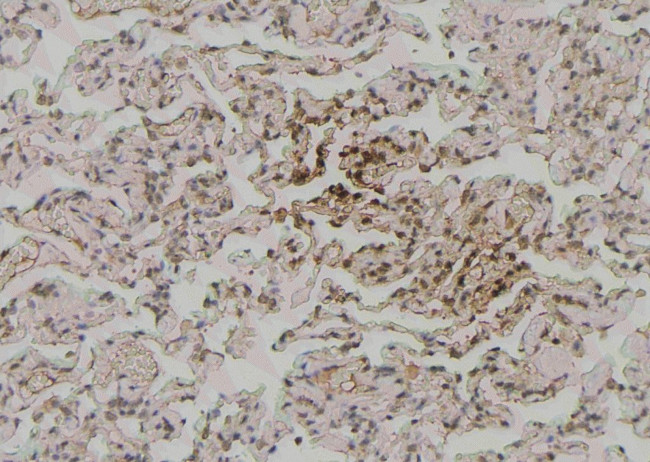 Phospho-Zyxin (Ser143) Antibody in Immunohistochemistry (Paraffin) (IHC (P))