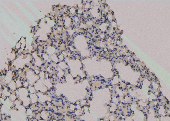 Phospho-Zyxin (Ser143) Antibody in Immunohistochemistry (Paraffin) (IHC (P))