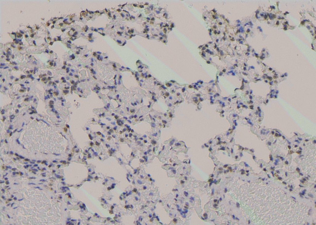 Phospho-Zyxin (Ser143) Antibody in Immunohistochemistry (Paraffin) (IHC (P))