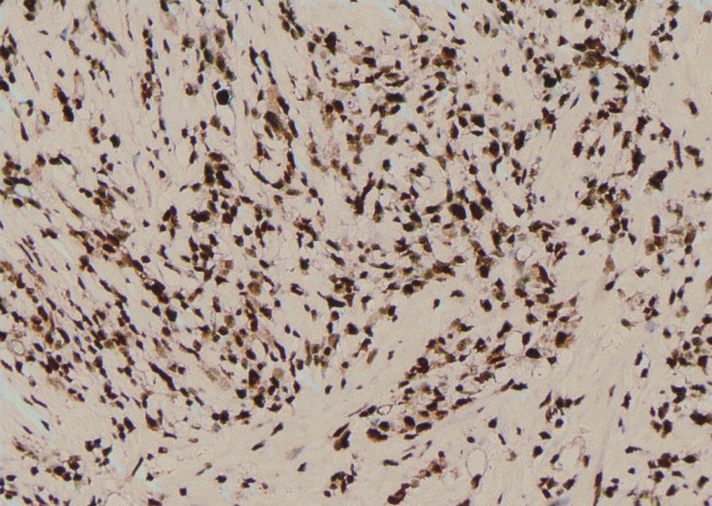 Phospho-PKN2 (Ser815) Antibody in Immunohistochemistry (Paraffin) (IHC (P))