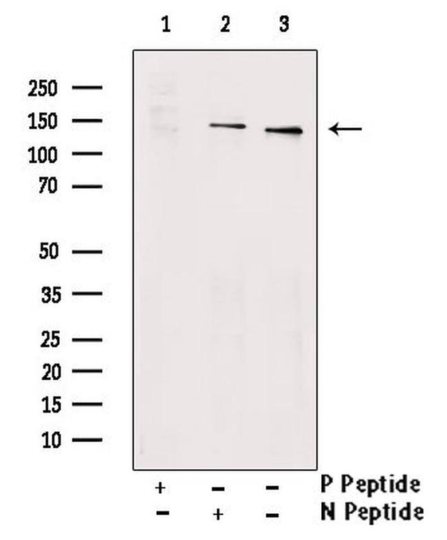 Phospho-PKN2 (Ser815) Antibody in Western Blot (WB)