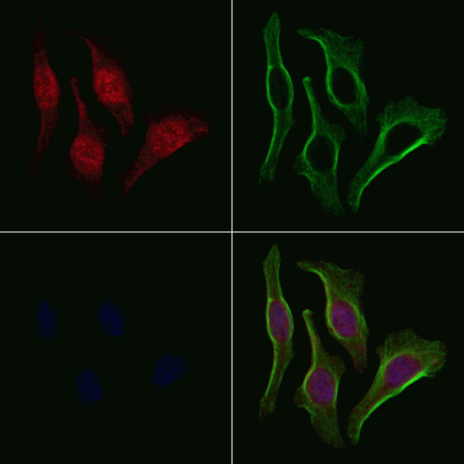 Phospho-TBC1D1 (Ser627) Antibody in Immunocytochemistry (ICC/IF)